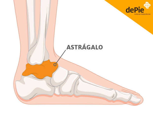 ¿Es Posible Caminar con el Astrágalo Roto? Todo lo que Necesitas Saber